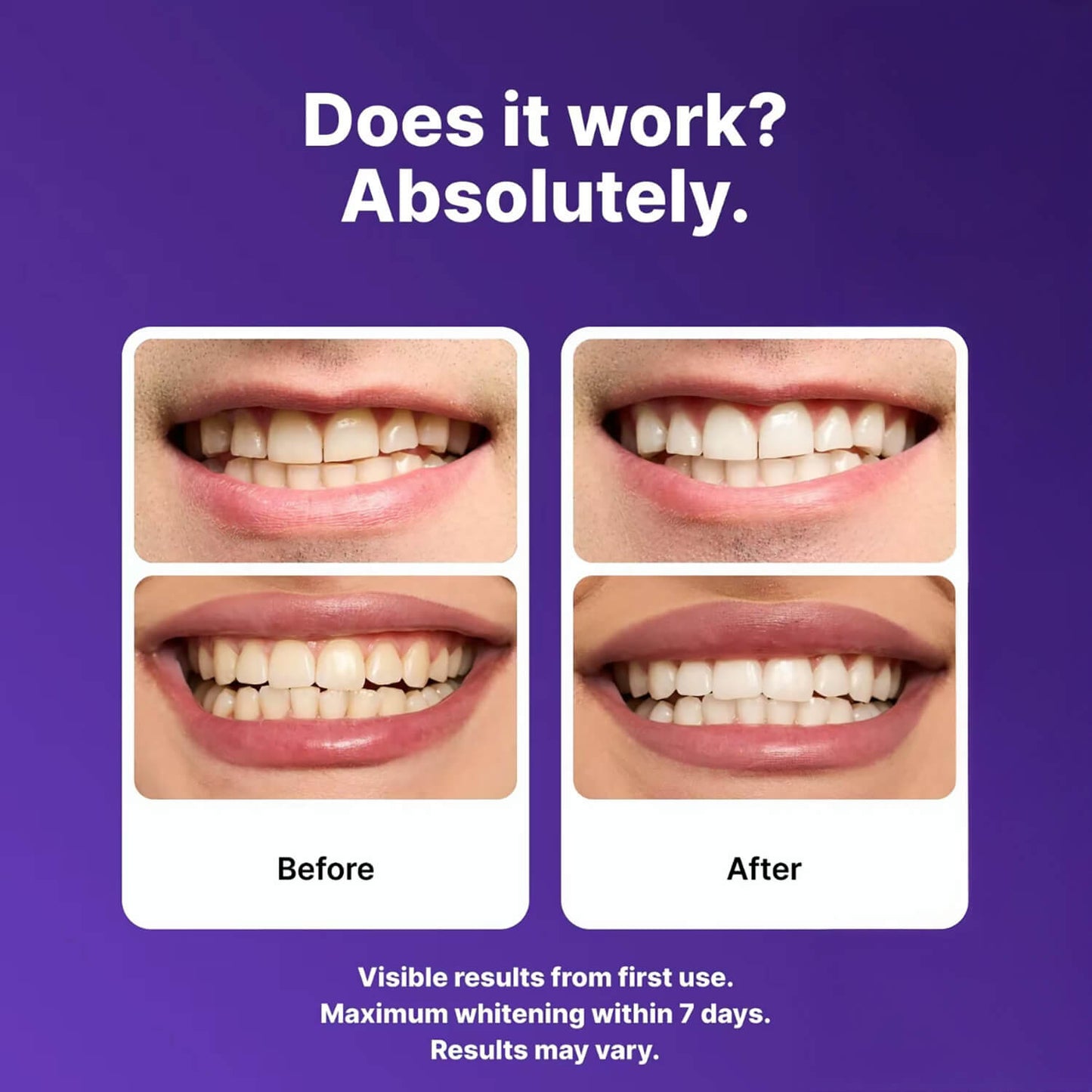 Neesia® Teeth Whitening Strips
